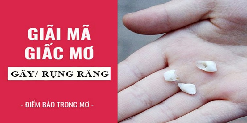 Ngủ mê gãy một chiếc răng