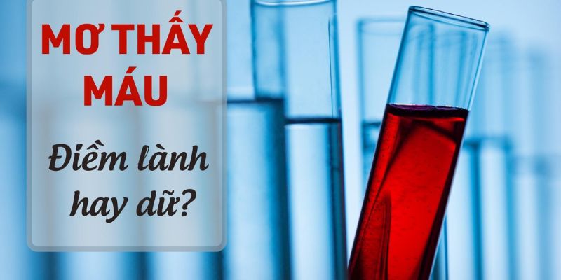 Nằm mơ thấy máu chơi lớn con số mấy?